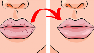 Avantajele cresterii volumului buzelor